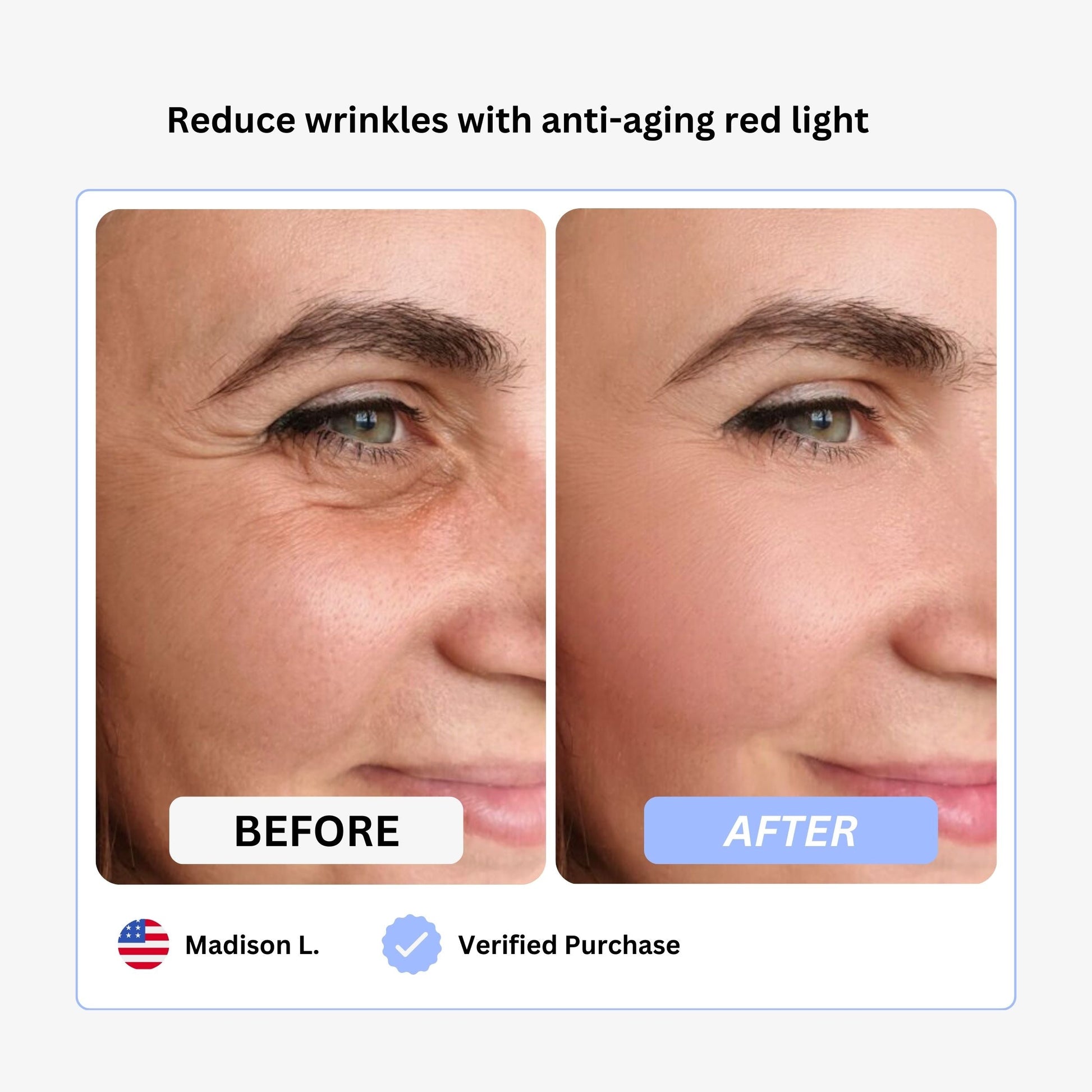 True Beauty Glow Face & Neck Lifting Device